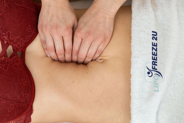 diastasis recti treatment Higham Ferrers