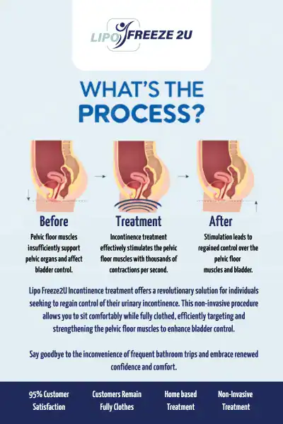 Diagram of how incontinence treatment Higham Ferrers works.