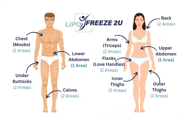 Areas you can have fat freezing treatment Higham Ferrers