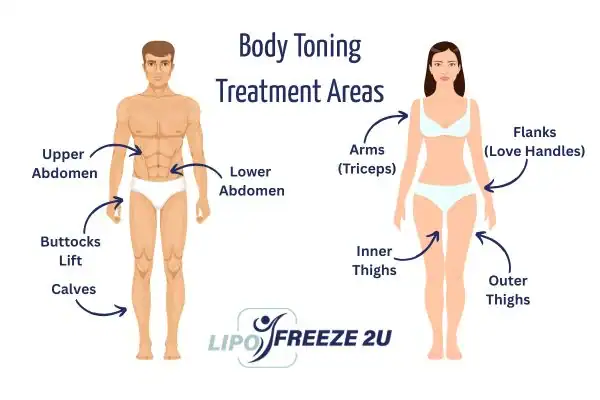 Graphic showing where you can have Body toning Treatment Higham Ferrers on your body