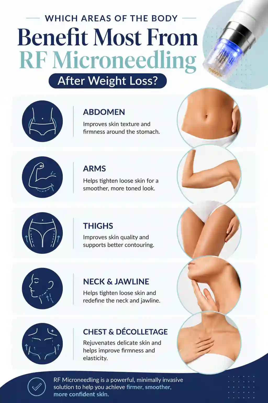 Which Areas of the Body Benefit Most From RF Microneedling After Weight Loss Higham Ferrers